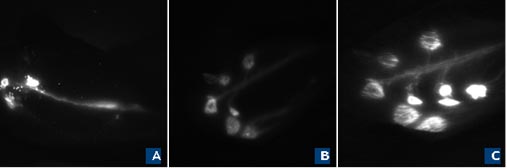 AJHMS N2 Antonyan Lymphatic 2