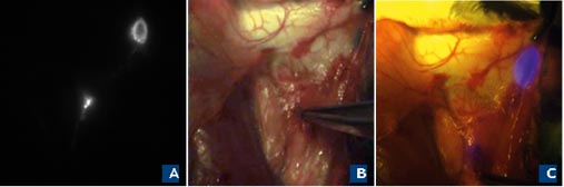 AJHMS N2 Antonyan Lymphatic 3
