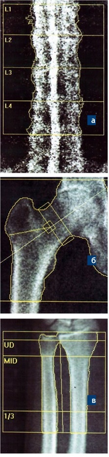 Aslanyan1